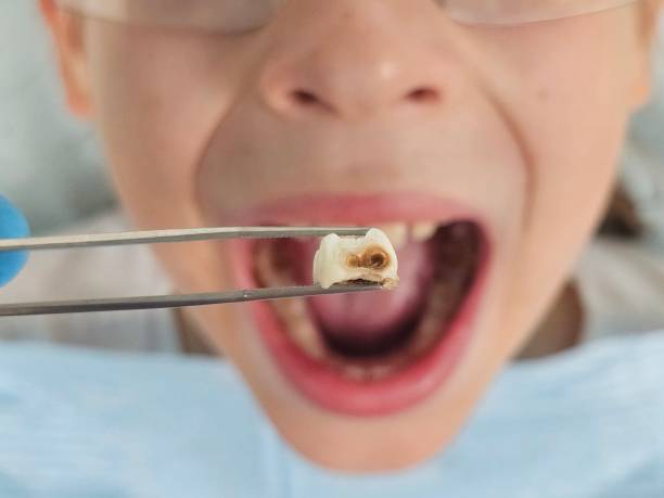 Best Mobile Emergency Dentist in Laramie, WY